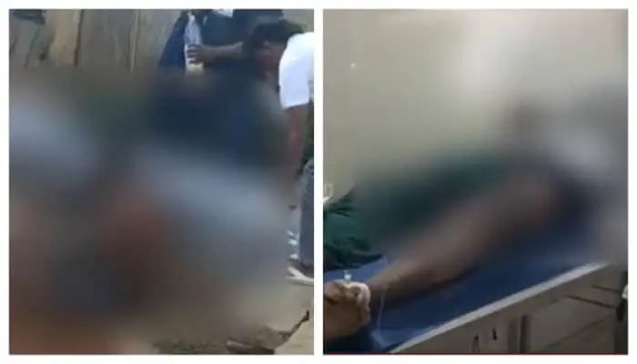 വിവാഹാഭ്യര്‍ത്ഥന നിരസിച്ച 18കാരിക്ക് നേരെ ആസിഡ് ആക്രമണം; ശേഷം തീകൊളുത്തി ജീവനൊടുക്കാൻ ശ്രമിച്ച്‌ 22കാരൻ; സംഭവം കര്‍ണാടകയില്‍