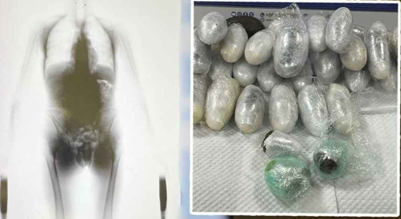 കുവൈത്ത് വിമാനത്താവളത്തിൽ വൻ മയക്കുമരുന്ന് വേട്ട; ശരീരത്തിനുള്ളിൽ ഒളിപ്പിച്ച ഹാഷിഷുമായി വിദേശി പിടിയിൽ